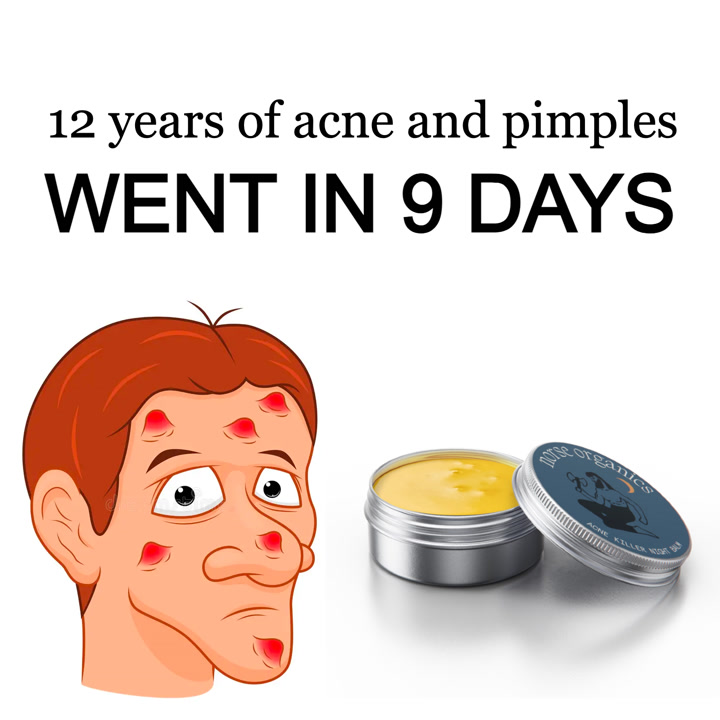 ad